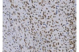 IHC analysis of Gpnmb using anti-Gpnmb antibody (ABIN7600217). (Osteoactivin Antikörper  (AA 164-564))