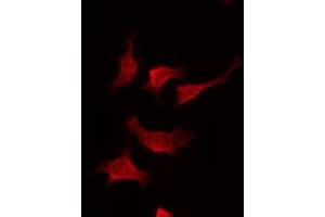 ABIN6275016 staining Hela by IF/ICC. (Claudin 19 Antikörper  (Internal Region))