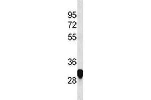 PLP antibody western blot analysis in HeLa lysate (PLP1 Antikörper  (AA 248-277))