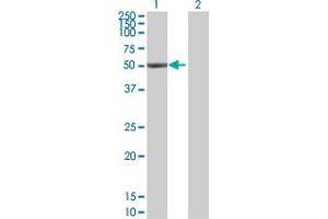 Western Blot analysis of ALDH1A1 expression in transfected 293T cell line by ALDH1A1 MaxPab polyclonal antibody. (ALDH1A1 Antikörper  (AA 1-501))