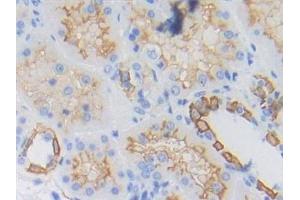 Detection of CYFRA21-1 in Human Kidney Tissue using Polyclonal Antibody to Cytokeratin Fragment Antigen 21-1 (CYFRA21-1)