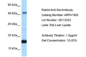 Host: Rabbit Target Name: SST Sample Tissue: Rat Liver Antibody Dilution: 1ug/ml (Somatostatin Antikörper  (N-Term))