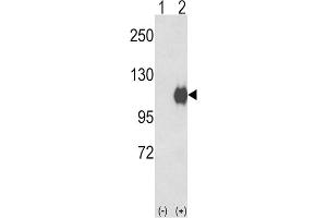 Western Blotting (WB) image for anti-Ectonucleotide Pyrophosphatase/phosphodiesterase 2 (ENPP2) antibody (ABIN2927789) (ENPP2 Antikörper)