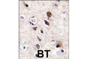 Formalin-fixed and paraffin-embedded human brain tissue reacted with PKC gamma antibody , which was peroxidase-conjugated to the secondary antibody, followed by DAB staining. (PKC gamma Antikörper  (C-Term))
