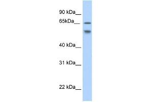 Western Blot showing RBM35B antibody used at a concentration of 1-2 ug/ml to detect its target protein. (ESRP2 Antikörper  (N-Term))