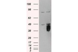 Western Blotting (WB) image for anti-Tissue Factor Pathway Inhibitor (Lipoprotein-Associated Coagulation Inhibitor) (TFPI) (C-Term) antibody (ABIN2465317) (TFPI Antikörper  (C-Term))