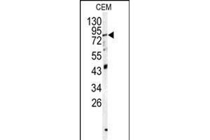 Western blot analysis of PSS1 antibody (N-term K9) (ABIN1882107 and ABIN2839313) in CEM cell line lysates (35 μg/lane). (PAPSS1 Antikörper  (N-Term))