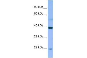 WB Suggested Anti-MBIP Antibody Titration: 1. (MBIP Antikörper  (N-Term))
