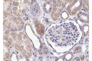 ABIN6267421 at 1/100 staining human kidney tissue sections by IHC-P. (Phospholipase C gamma 1 Antikörper  (pTyr783))