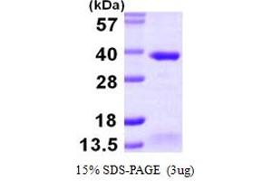 SDS-PAGE (SDS) image for AlkB, Alkylation Repair Homolog 2 (ALKBH2) (AA 1-261) protein (His tag) (ABIN667421) (ALKBH2 Protein (AA 1-261) (His tag))