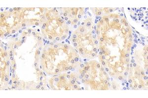 Detection of PARK7 in Human Kidney Tissue using Polyclonal Antibody to Parkinson Disease Protein 7 (PARK7) (PARK7/DJ1 Antikörper  (AA 1-189))