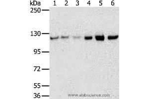 Western blot analysis of 823, A549, K562, 293T, hepg2 and huvec cell, using RBM5 Polyclonal Antibody at dilution of 1:450 (RBM5 Antikörper)