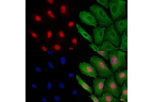 ABIN6257409 and ABIN6273693 staining  cells by IF/ICC. (PAK1IP1 Antikörper  (C-Term))