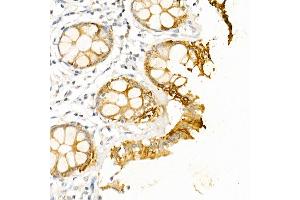 Immunohistochemistry of paraffin-embedded human colon using Cytokeratin 19 (KRT19) Rabbit pAb (ABIN3020778, ABIN3020779, ABIN3020780 and ABIN6213719) at dilution of 1:50 (40x lens). (Cytokeratin 19 Antikörper  (AA 241-400))