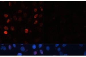 Immunofluorescence analysis of C6 cells using Phospho-γH2A. (gamma H2AX Antikörper  (pSer139))