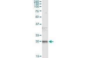 Immunoprecipitation of FTL transfected lysate using anti-FTL monoclonal antibody and Protein A Magnetic Bead , and immunoblotted with FTL MaxPab rabbit polyclonal antibody. (FTL Antikörper)