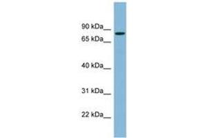 Image no. 1 for anti-Erythrocyte Membrane Protein Band 4.1 (Elliptocytosis 1, RH-Linked) (EPB41) (AA 107-156) antibody (ABIN6742061) (EPB41 Antikörper  (AA 107-156))