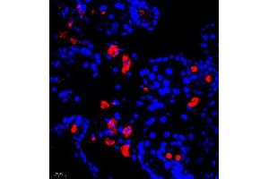 Immunofluorescence of paraffin embedded mouse breast using Calcitonin (ABIN7073271) at dilution of 1:650 (400x lens) (Calcitonin Antikörper)