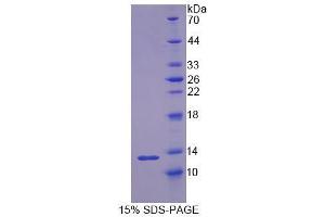 Image no. 1 for Resistin (RETN) (AA 22-109) protein (His tag) (ABIN6238564) (Resistin Protein (RETN) (AA 22-109) (His tag))