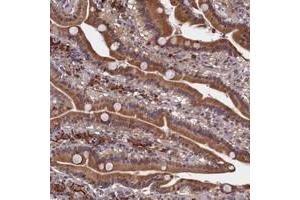 Immunohistochemical staining of human duodenum with SLC16A14 polyclonal antibody  shows moderate cytoplasmic positivity in glandular cells.