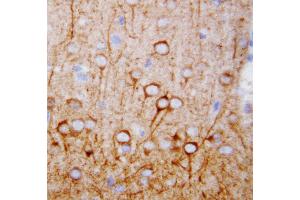 Anti-CaMKK antibody, IHC(P) IHC(P): Rat Brain Tissue (CAMKK1 Antikörper  (N-Term))