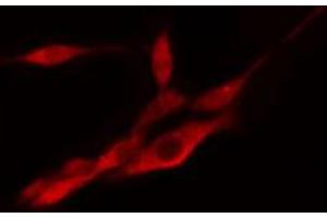 ABIN6274333 staining COLO205 cells by IF/ICC. (PSMD2 Antikörper  (Internal Region))