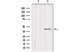 Western blot analysis of extracts from Mouse cancer, using MKP-2 Antibody. (DUSP4 Antikörper  (Internal Region))