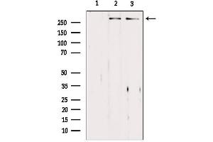 Western blot analysis of extracts from various samples, using ASPM Antibody. (ASPM Antikörper  (Internal Region))
