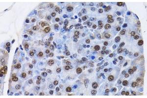 Immunohistochemistry (Paraffin-embedded Sections) (IHC (p)) image for anti-Inhibitor of DNA Binding 3, Dominant Negative Helix-Loop-Helix Protein (ID3) antibody (ABIN7261327)
