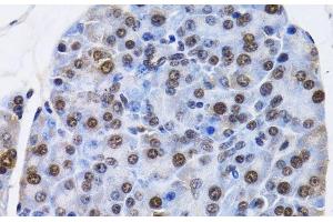 Immunohistochemistry of paraffin-embedded Mouse pancreas using ID3 Polyclonal Antibody at dilution of 1:200 (40x lens). (ID3 Antikörper)