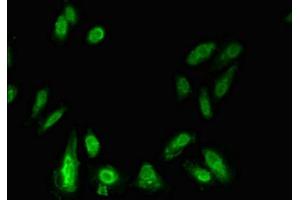 Immunofluorescent analysis of Hela cells using ABIN7155905 at dilution of 1:100 and Alexa Fluor 488-congugated AffiniPure Goat Anti-Rabbit IgG(H+L) (LIPE Antikörper  (AA 1-251))