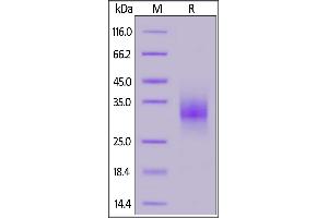 SDS-PAGE (SDS) image for Fc Fragment of IgG, Low Affinity IIa, Receptor (CD32) (FCGR2A) (AA 34-217) protein (His tag) (ABIN7013408)