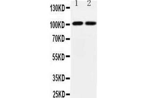 Observed bind size: 101KD (Glutamate Receptor 3 Antikörper  (Middle Region))
