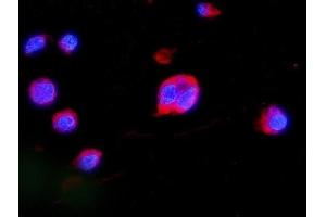 IF analysis of MEK2/MAP2K2 using anti-MEK2/MAP2K2 antibody (ABIN7599357). (MEK2 Antikörper  (AA 1-400))