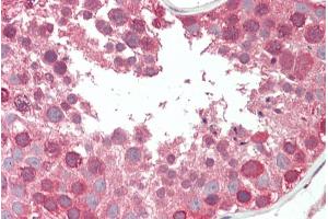 ABIN308445 (5µg/ml) staining of paraffin embedded Human Testis. (COG7 Antikörper  (Internal Region))