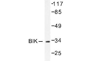 Image no. 1 for anti-BCL2-Interacting Killer (Apoptosis-Inducing) (BIK) antibody (ABIN265329) (BIK Antikörper)