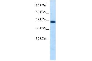 WB Suggested Antibody Titration:  0. (HNF1B Antikörper  (N-Term))