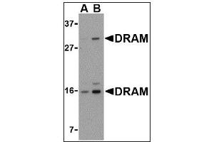 Image no. 2 for anti-DNA-Damage Regulated Autophagy Modulator 1 (DRAM1) (C-Term) antibody (ABIN372924) (DRAM Antikörper  (C-Term))