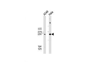 Western Blot at 1:2000 dilution Lane 1: A549 whole cell lysate Lane 2: Hela whole cell lysate Lysates/proteins at 20 ug per lane. (WNK1 Antikörper  (AA 1848-1882))