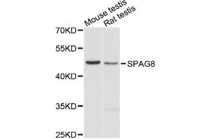 Western blot analysis of extracts of various cell lines, using SPAG8 antibody. (SPAG8 Antikörper)