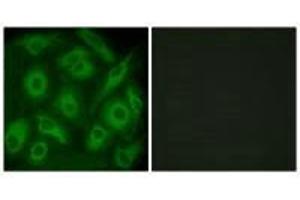 Immunofluorescence analysis of HeLa cells, using CDH23 antibody. (CDH23 Antikörper)