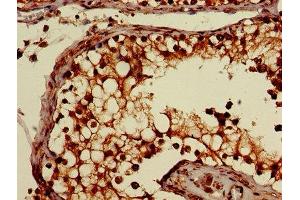 Immunohistochemistry of paraffin-embedded human testis tissue using ABIN7170052 at dilution of 1:100