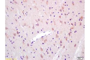 Formalin-fixed and paraffin embedded rat brain labeled with Anti-KAT2B/ GCN5/PCAF Polyclonal Antibody, Unconjugated (ABIN755287) at 1:200 followed by conjugation to the secondary antibody and DAB staining.