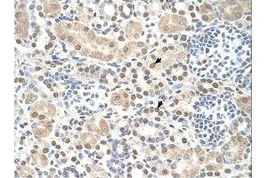 ST8SIA2 antibody was used for immunohistochemistry at a concentration of 4-8 ug/ml. (ST8SIA2 Antikörper  (C-Term))
