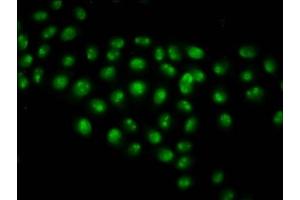 Immunofluorescence (IF) image for anti-Histone Cluster 1, H2ag (HIST1H2AG) (acLys13) antibody (ABIN7139157)