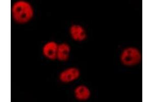 ABIN6277282 staining  HepG2 cells by IF/ICC. (PDCD4 Antikörper  (N-Term))