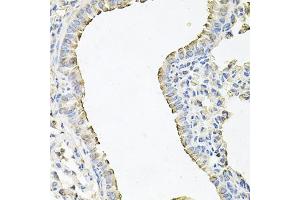 Immunohistochemistry of paraffin-embedded mouse lung using SCNN1G antibody (ABIN6129468, ABIN6147453, ABIN6147454 and ABIN6221724) at dilution of 1:100 (40x lens). (SCNN1G Antikörper  (AA 85-355))