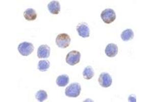 Immunocytochemistry of DDX3 in HepG2 cells with AP30282PU-N DDX3 antibody at 10 μg/ml. (DDX3X Antikörper  (N-Term))