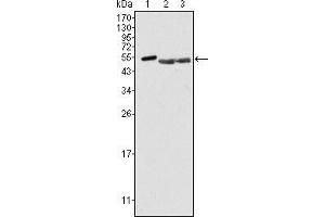 Western blot analysis using PTK6 mouse mAb against Hela (1), A549 (2) and MCF-7 (3) cell lysate. (PTK6 Antikörper)