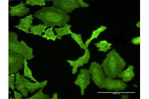 Immunofluorescence (IF) image for anti-Membrane Protein, Palmitoylated 5 (MAGUK P55 Subfamily Member 5) (MPP5) (AA 1-675) antibody (ABIN949595)